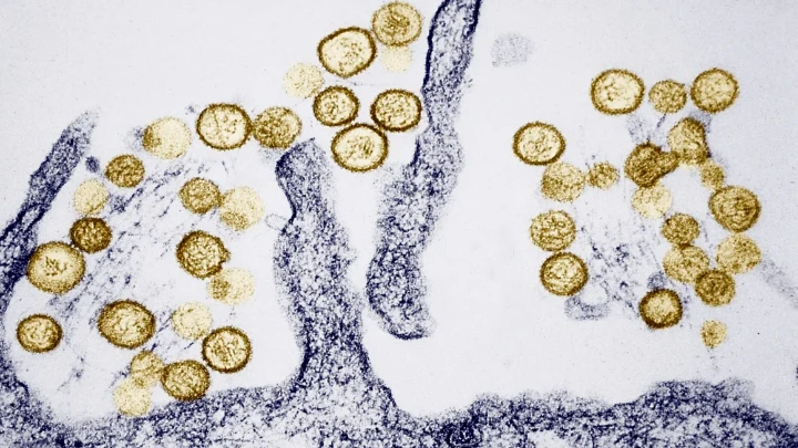 A virus called Sin Nombre is the most common hantavirus in the Southwestern US. BSIP/Universal Images Group Editorial/Getty Images